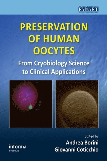 Giovanni Coticchio, Andrea Borini - Preservation of Human Oocytes, E-bok
