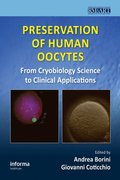 Preservation of Human Oocytes