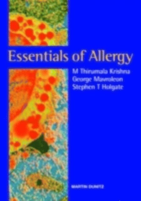 Stephen T Holgate, George Mavroleon, M Thirumala Krishna - Essentials of Allergy, E-bok