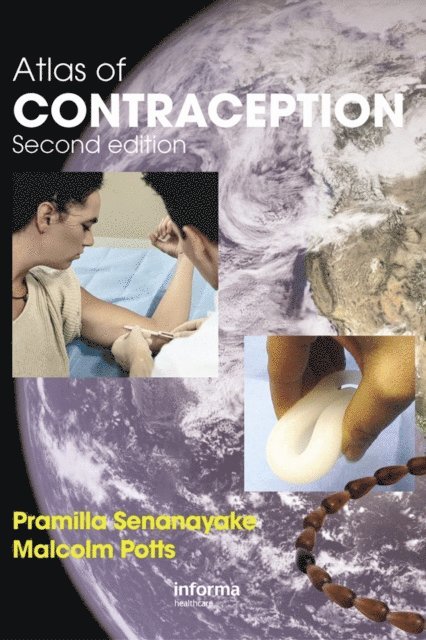 Malcolm Potts, Pramilla Senanayake - Atlas of Contraception, E-bok