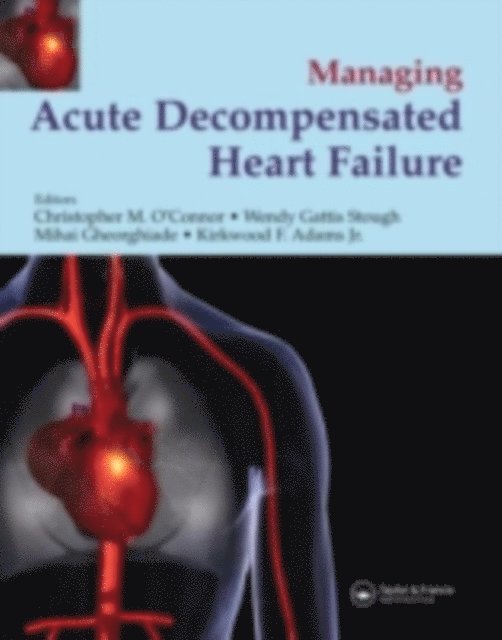 Management of Acute Decompensated Heart Failure
