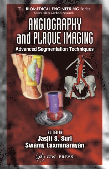 Swamy Laxminarayan, Jasjit S. Suri - Angiography and Plaque Imaging, E-bok