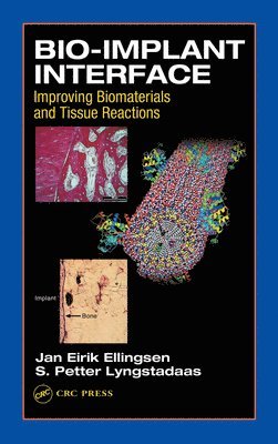 S.P. Lyngstadaas, J.E. Ellingsen - Bio-Implant Interface, E-bok