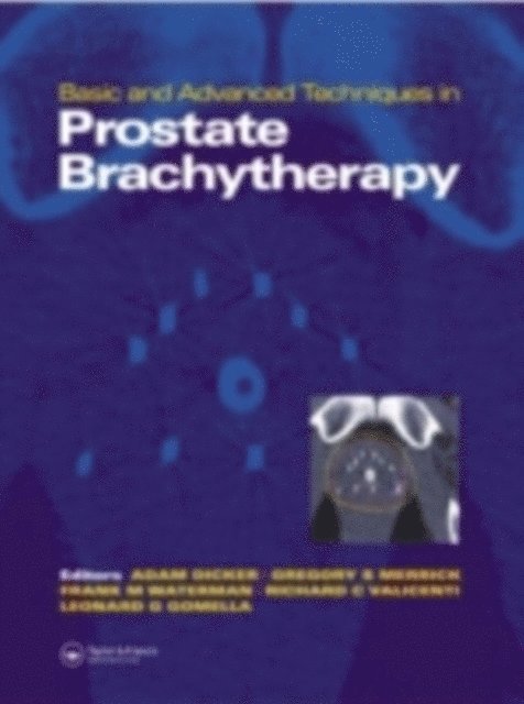 Frank Waterman, Richard K. Valicenti, Leonard Gomella, Gregory Merrick, Adam P. Dicker - Basic and Advanced Techniques in Prostate Brachytherapy, E-bok