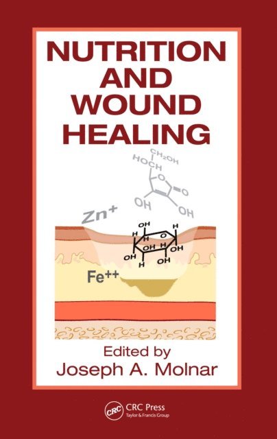 Joseph A. Molnar,MD,PhD,FACS - Nutrition and Wound Healing, E-bok