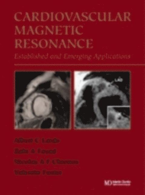 Krishna S. Nayak, Gerald M. Pohost - Handbook of Cardiovascular Magnetic Resonance Imaging, E-bok