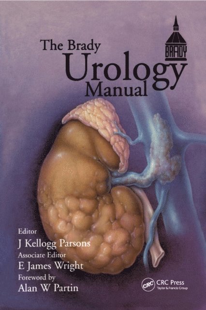 E. James Wright, J. Kellogg Parsons - Brady Urology Manual, E-bok