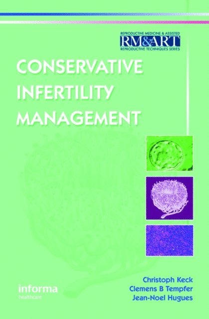 Jean Noel Hugues, Clemens B. Tempfer, Christoph Keck - Conservative Infertility Management, E-bok