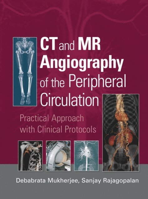 Sanjay Rajagopalan, Debabrata Mukherjee - CT and MR Angiography of the Peripheral Circulation, E-bok
