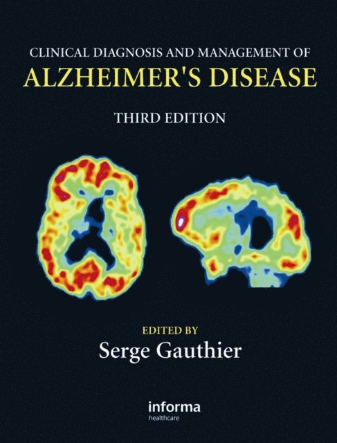 Serge Gauthier - Clinical Diagnosis and Management of Alzheimer's Disease, E-bok