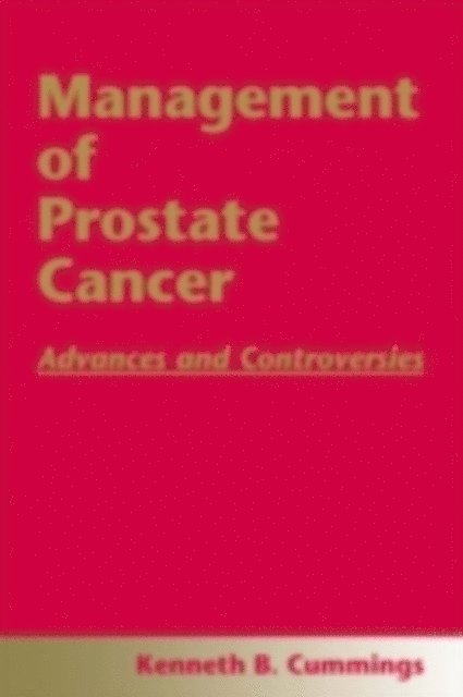 Kenneth B. Cummings - Management of Prostate Cancer, E-bok. Tillgänglighet: Lägg i varukorg