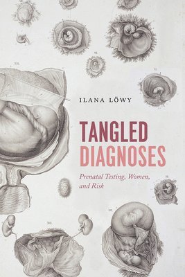 Ilana Lowy - Tangled Diagnoses, Inbunden