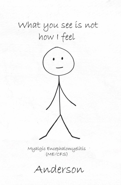 Anderson - What You See Is Not How I Feel, E-bok
