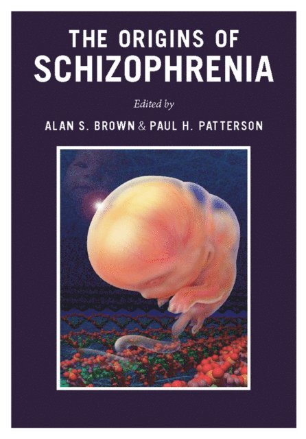 Alan S. Brown, Paul H. Patterson - Origins of Schizophrenia, E-bok