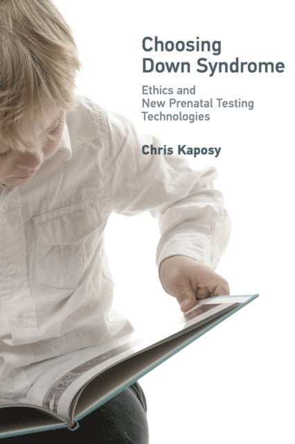 Chris Kaposy - Choosing Down Syndrome, E-bok