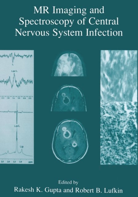 Robert B. Lufkin, Rakesh K. Gupta - MR Imaging and Spectroscopy of Central Nervous System Infection, E-bok