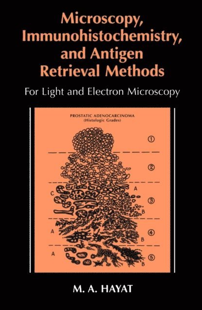 M.A. Hayat - Microscopy, Immunohistochemistry, and Antigen Retrieval Methods, E-bok. Tillgänglighet: Lägg i varukorg