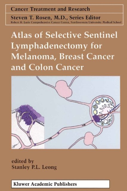 Stanley P. L. Leong - Atlas of Selective Sentinel Lymphadenectomy for Melanoma, Breast Cancer and Colon Cancer, E-bok