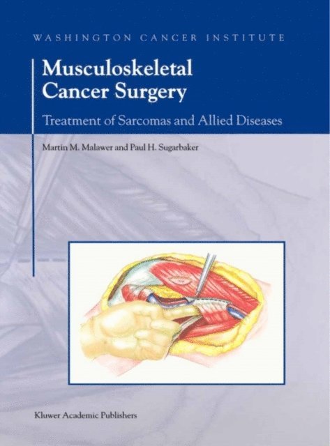 Paul H. Sugarbaker, Martin M. Malawer - Musculoskeletal Cancer Surgery, E-bok