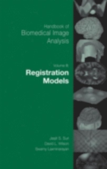 Swamy Laxminarayan, David Wilson - Handbook of Biomedical Image Analysis, E-bok