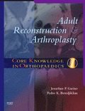 Core Knowledge in Orthopaedics: Adult Reconstruction and Arthroplasty