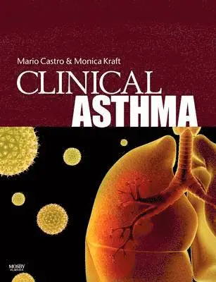 Mario Castro, Monica Kraft - Clinical Asthma, Inbunden. Tillgänglighet: Lägg i varukorg