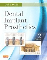 Carl E. Misch - Dental Implant Prosthetics, Inbunden. Tillgänglighet: Lägg i varukorg