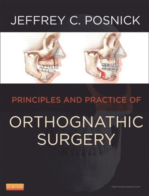 Jeffrey C. Posnick - Orthognathic Surgery, E-bok