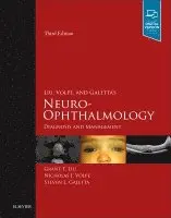 Grant T. Liu, Nicholas J. Volpe, Steven L. Galetta - Liu, Volpe, and Galetta's Neuro-Ophthalmology, Inbunden. Tillgänglighet: Lägg i varukorg