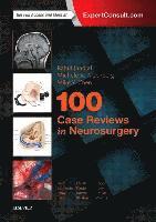 100 Case Reviews in Neurosurgery