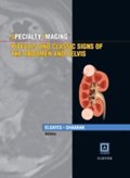 Specialty Imaging: Pitfalls and Classic Signs of the Abdomen and Pelvis E-Book
