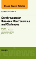 William J. Powers - Cerebrovascular Diseases: Controversies and Challenges, An Issue of Neurologic Clinics, Inbunden