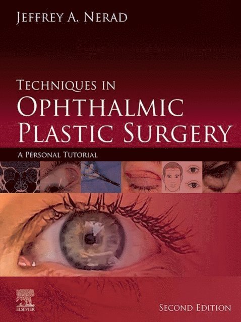 Jeffrey A. Nerad - Techniques in Ophthalmic Plastic Surgery E-Book, E-bok