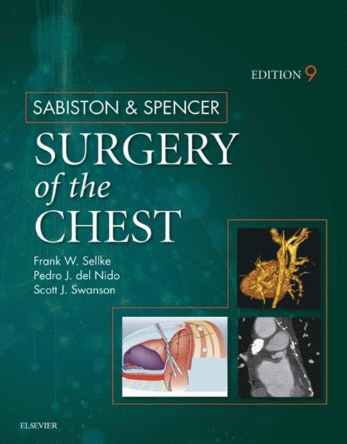 Scott J. Swanson, Pedro J. del Nido, Frank W. Sellke - Sabiston and Spencer Surgery of the Chest E-Book, E-bok