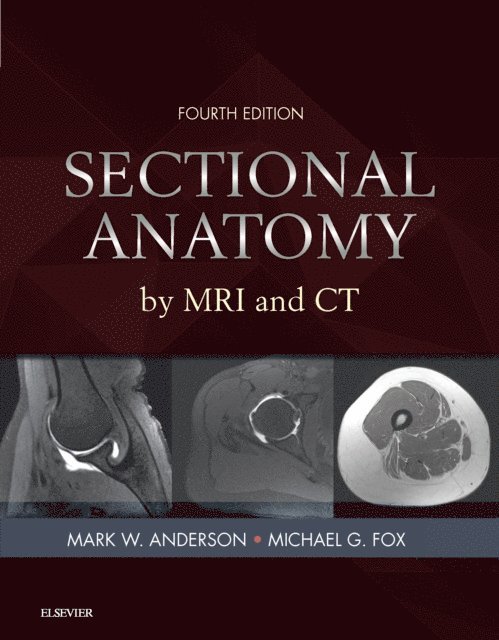 Michael G. Fox, Mark W. Anderson - Sectional Anatomy by MRI and CT E-Book, E-bok