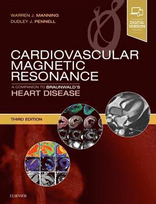 Cardiovascular Magnetic Resonance av Warren J Manning, Dudley J Pennell