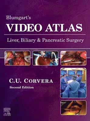 Carlos Corvera - Blumgart's Video Atlas: Liver, Biliary & Pancreatic Surgery E-Book, E-bok