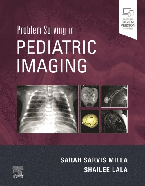 Shailee Lala, Sarah Sarvis Milla - Problem Solving in Pediatric Imaging E-Book, E-bok