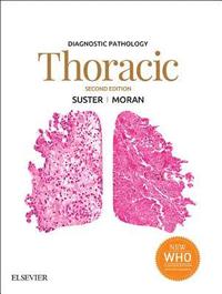 Diagnostic Pathology: Thoracic E-Book