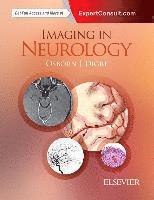 Imaging in Neurology