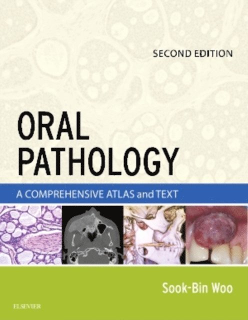 Sook-Bin Woo - Oral Pathology E-Book, E-bok