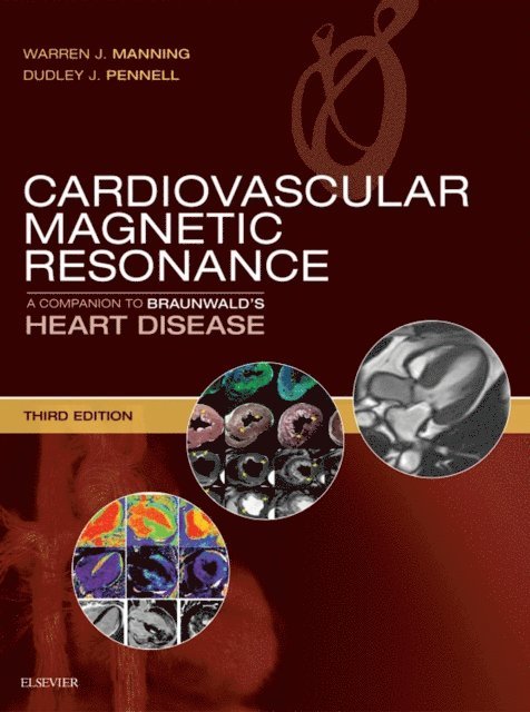 Dudley J. Pennell, Warren J. Manning - Cardiovascular Magnetic Resonance, E-bok