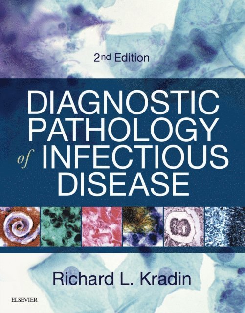 Richard L. Kradin - Diagnostic Pathology of Infectious Disease E-Book, E-bok