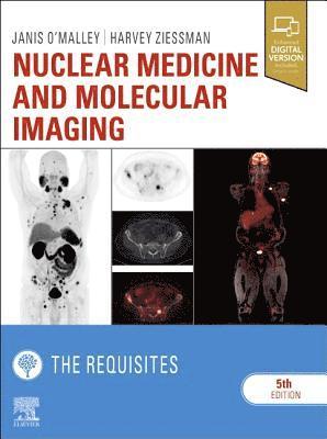Nuclear Medicine and Molecular Imaging: The Requisites av Janis P O'Malley, Harvey A Ziessman