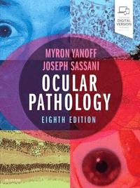 Ocular Pathology