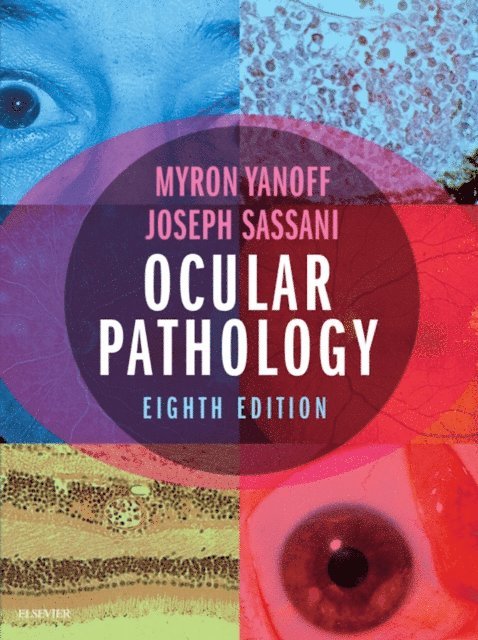 Joseph W. Sassani, Myron Yanoff - Ocular Pathology, E-bok