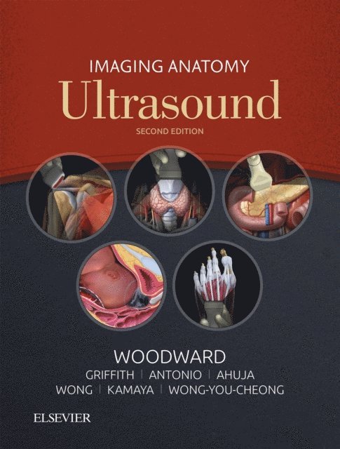 Jade Wong-You-Cheong, Aya Kamaya, K. T. Wong, Anil T. Ahuja, Gregory E. Antonio, James Griffith, Paula J. Woodward - Imaging Anatomy: Ultrasound E-Book, E-bok