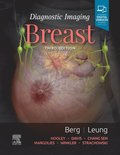 Diagnostic Imaging: Breast E-Book