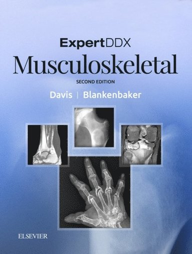 Donna G. Blankenbaker, Kirkland W. Davis - ExpertDDx: Musculoskeletal E-Book, E-bok