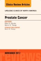 Marc A. Bjurlin, Samir S. Taneja - Prostate Cancer, An Issue of Urologic Clinics, Inbunden. Tillgänglighet: Lägg i varukorg